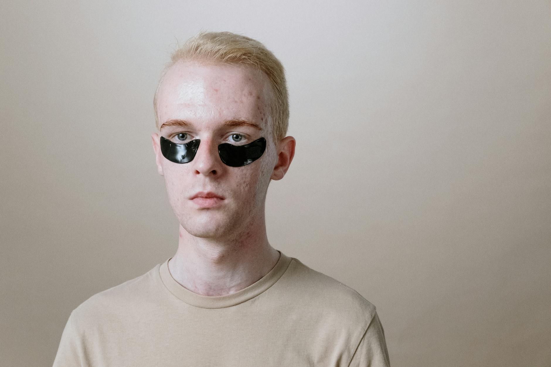 Portrait of a young man wearing under-eye patches, focusing on skincare and self-care routine. - natural acne treatment