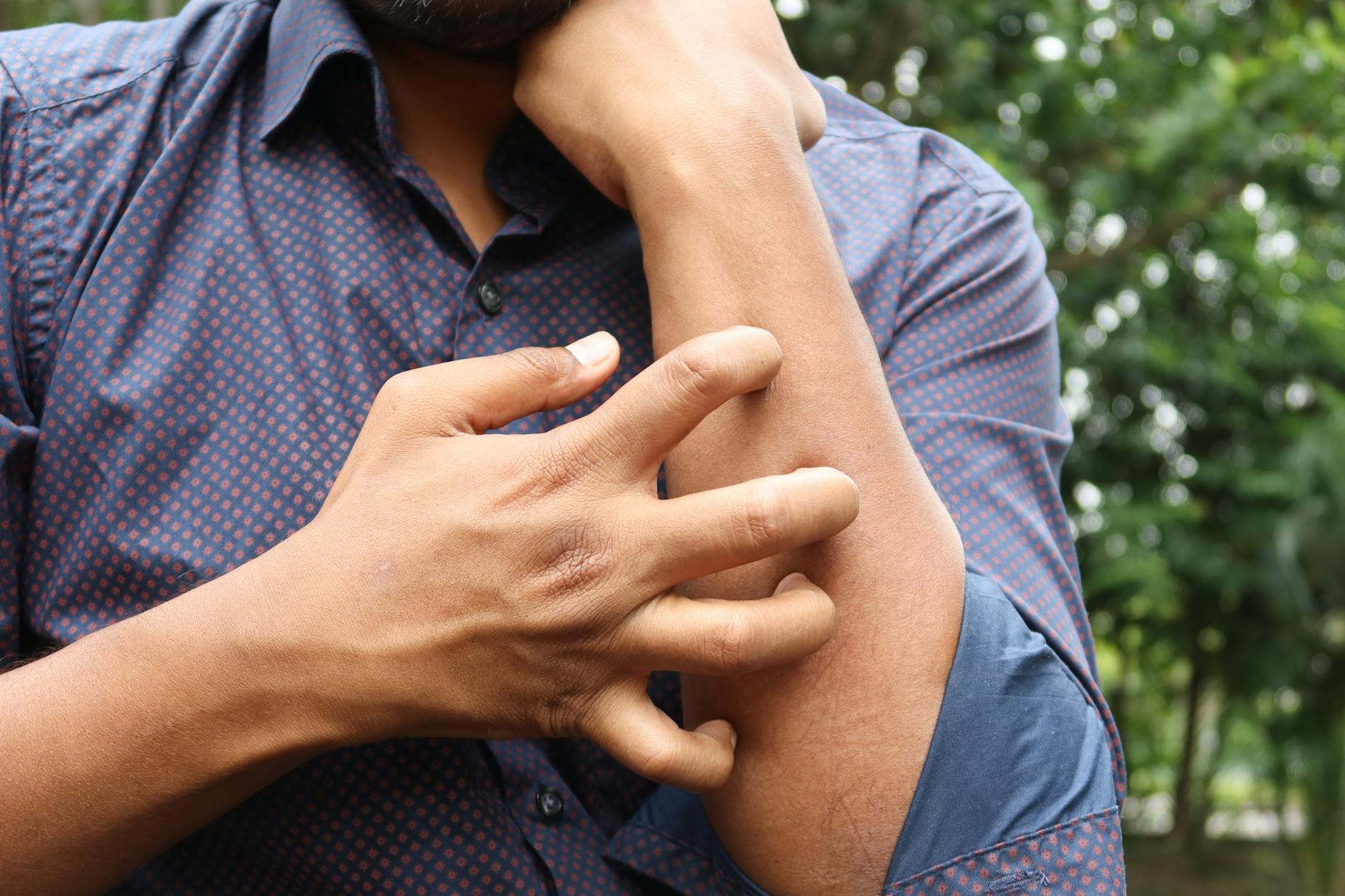 A man in a blue shirt scratching his arm outdoors, highlighting skin irritation. - foods for allergy relief